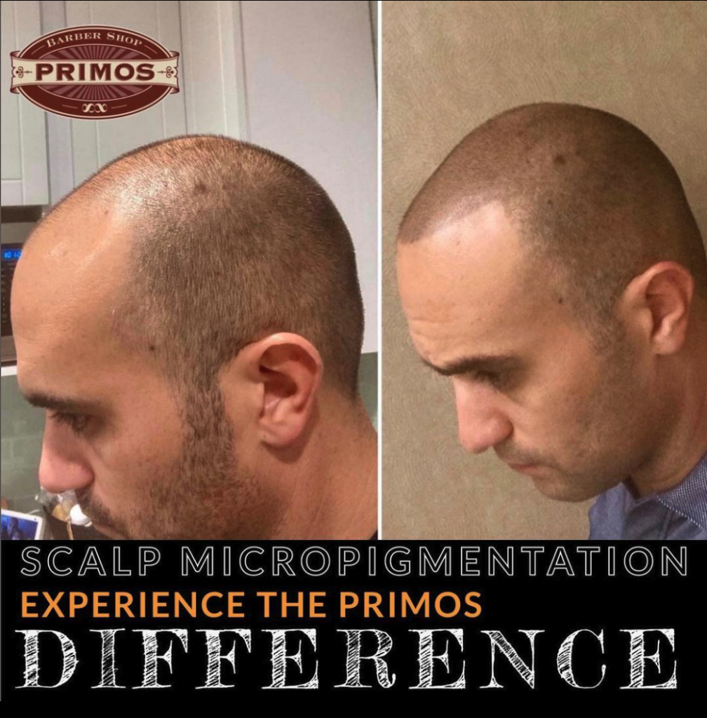 Experience Scalp Micropigmentation at Primos Barbershop